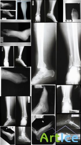 X-Rays Textures 6 JPG Files