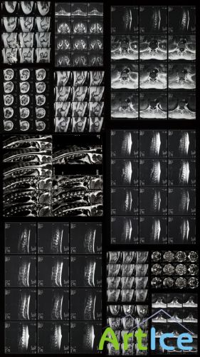 X-Rays Textures 8 JPG Files